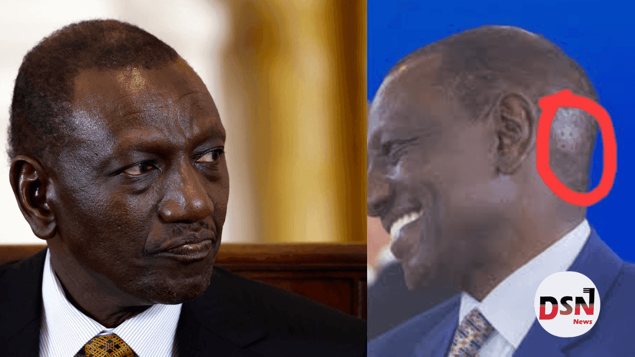 Why People Think President Ruto Has Four Holes in His Head