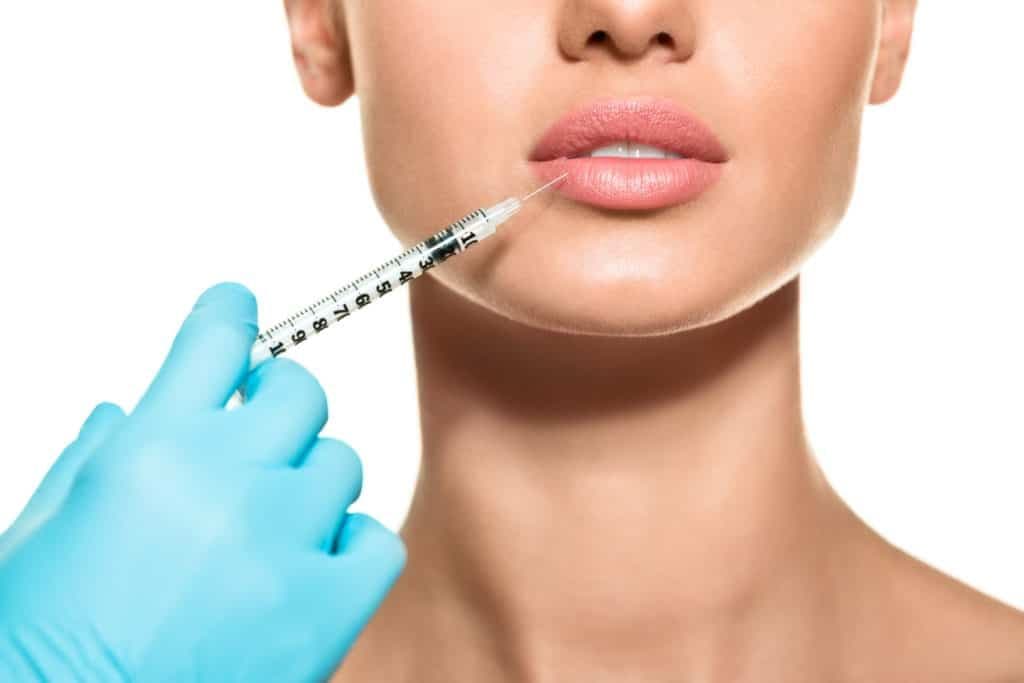 Everything You Need to Know About Lip Augmentation