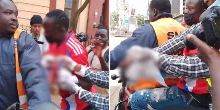 Protester Suffers Severe Hand Injury After Tear Gas Canister Explosion in Nairobi CBD